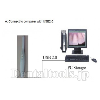Magenta® CF-688A歯科用口腔内カメラ (USB&OTG)
