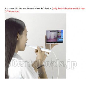 MLG® CF-683A歯科用口腔内カメラ (USB&OTG&TV)