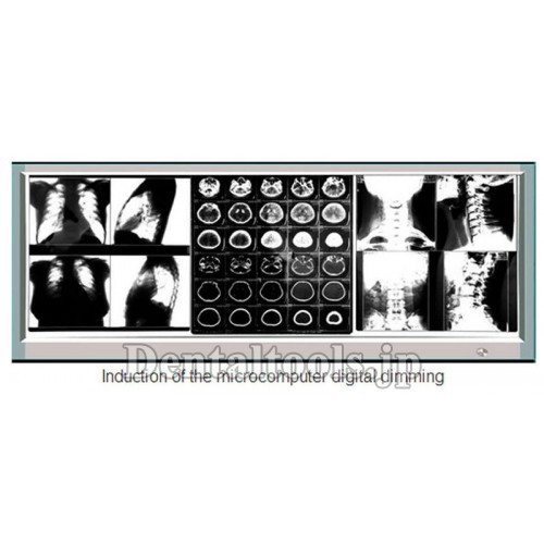 超薄型X線フィルムビューア医療診断LED照明フィルム観察箱1100H