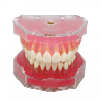 高品質脱着可能歯列模型 歯科研究治療説明用上下顎義歯模型 実用的 クリアベース ピンク