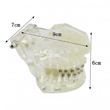 高品質歯列矯正治療説明用上下顎模型 ブラケットモデル セラミックメタルクリアベース