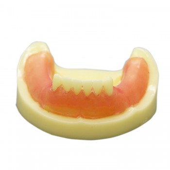 歯科インプラント研究用標準教学道具 歯科練習用下顎義歯模型 イエローベース