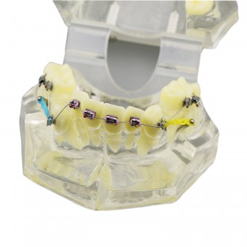 歯科上下顎180度開閉式歯列矯正模型 矯正歯科治療用研究用 ブラケットモデル パワーチェーン装着