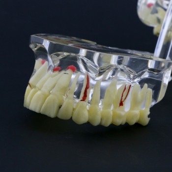 新しい歯科模型 成人病理歯模型 歯列モデル 模型 教学 研究 説明用 #4001