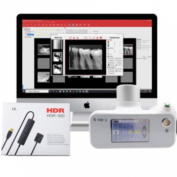 歯科用X Ray II タッチスクリーンポータブルX線診断装置 + Handy HDR 500/600歯科用X線センサー