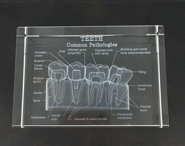 歯科水晶内部歯解剖図嵌め込み 歯科教学水晶置物歯科装飾品プレゼント