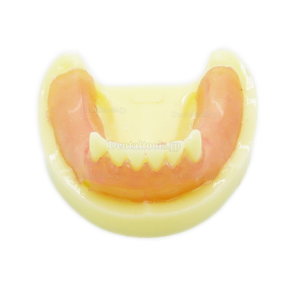 歯科インプラント研究用標準教学道具 歯科練習用下顎義歯模型 イエローベース