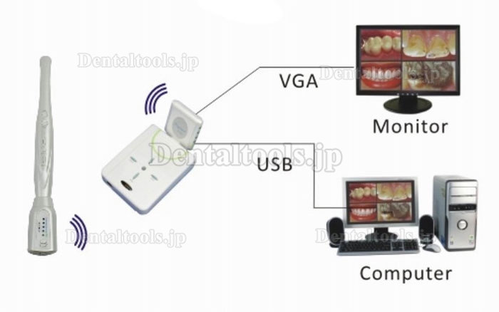 Magenta®歯科用·家庭用口腔内カメラMD910AW 無線（USB2.0＆VGA）