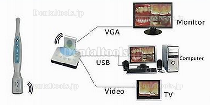 Magenta® MD9503OW歯科用·家庭用口腔内カメラ 無線（USB2.0＆VGA、VIDEO）