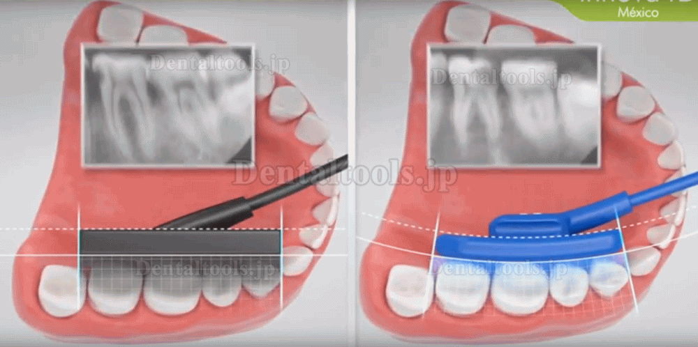 VATECH EZSensor Soft Type Dental X Ray Sensor