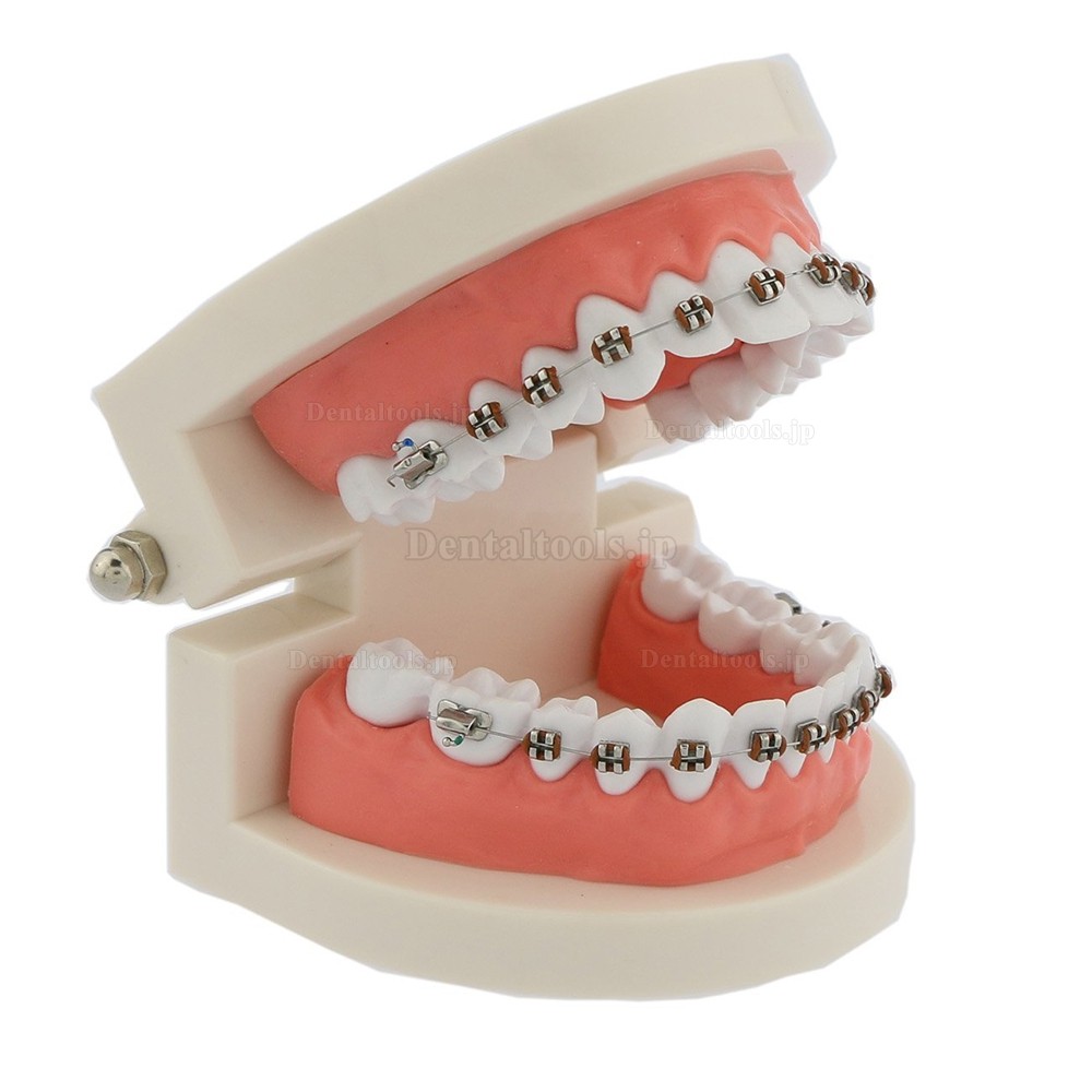 歯科矯正治療180度開閉式説明用模型 メタルブラケット装置上下額歯列模型  白
