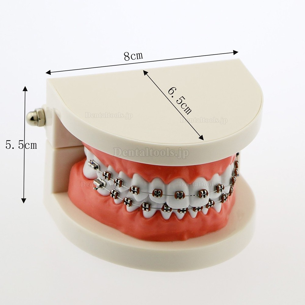 歯科矯正治療180度開閉式説明用模型 メタルブラケット装置上下額歯列模型  白