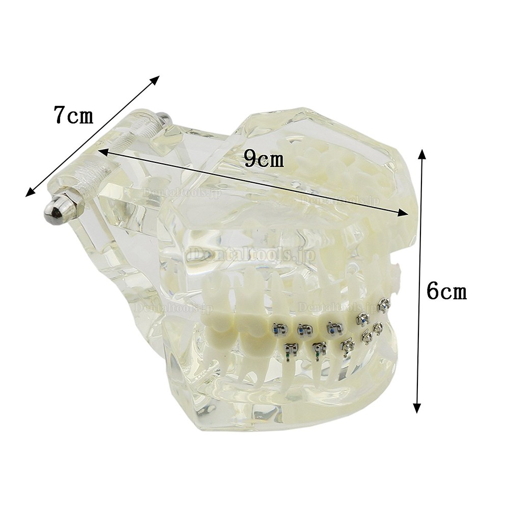 高品質歯列矯正治療説明用上下顎模型 ブラケットモデル セラミックメタルクリアベース